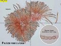 Peziza vesiculosa-amf1422-micro